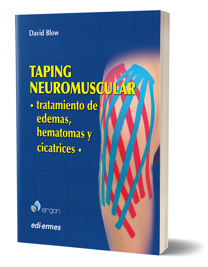 Taping NeuroMuscular - Tratamiento de edemas, hematomas y cicatrices